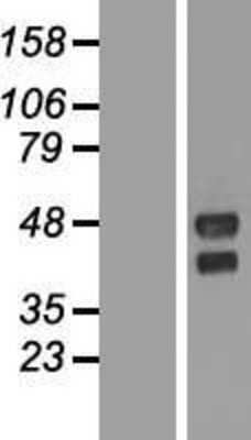 Western Blot: TMEM151A Overexpression Lysate [NBL1-17024]