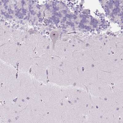 Immunohistochemistry-Paraffin: TMEM151B Antibody [NBP2-30694]
