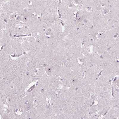 Immunohistochemistry-Paraffin: TMEM151B Antibody [NBP2-30694]