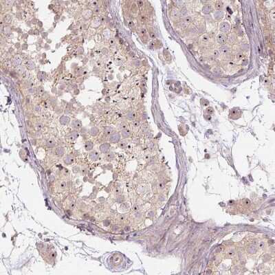 Immunohistochemistry-Paraffin: TMEM151B Antibody [NBP2-30694]