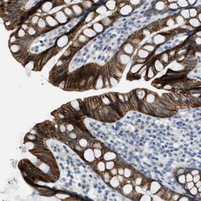 Immunohistochemistry-Paraffin: TMEM154 Antibody [NBP2-34184]