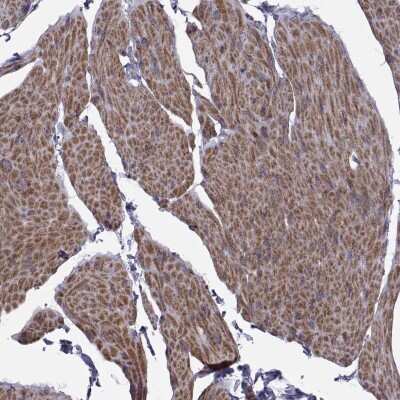 Immunohistochemistry-Paraffin: TMEM158 Antibody [NBP2-68993]