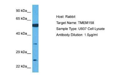 Western Blot: TMEM158 Antibody [NBP1-91300]