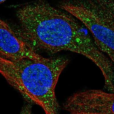 Immunocytochemistry/ Immunofluorescence: TMEM159 Antibody [NBP2-56349]