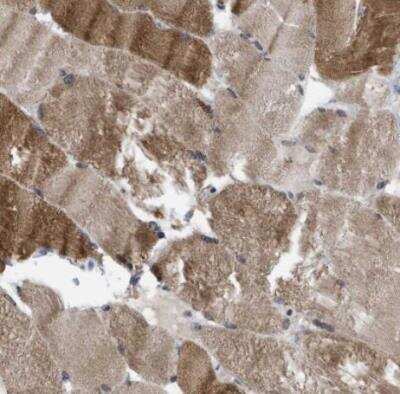 Immunohistochemistry-Paraffin: TMEM159 Antibody [NBP1-80877]
