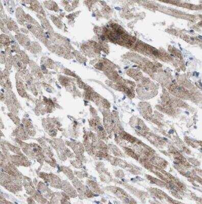 Immunohistochemistry-Paraffin: TMEM159 Antibody [NBP1-80877]