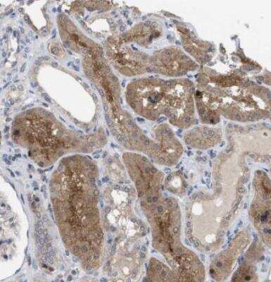Immunohistochemistry-Paraffin: TMEM159 Antibody [NBP1-80877]