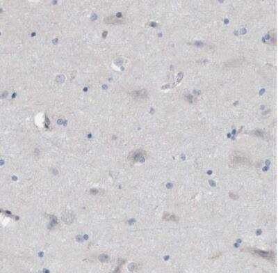 Immunohistochemistry-Paraffin: TMEM159 Antibody [NBP1-80877]