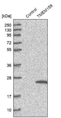 Western Blot: TMEM159 Antibody [NBP1-80877]