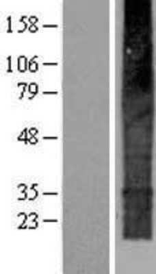 Western Blot: TMEM159 Overexpression Lysate [NBP2-06646]