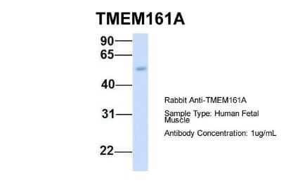 Western Blot: TMEM161A Antibody [NBP1-91304]