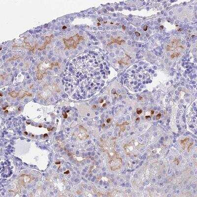 Immunohistochemistry-Paraffin: TMEM161B Antibody [NBP1-93488]