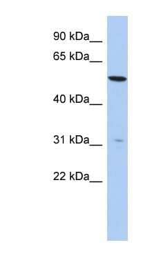 Western Blot: TMEM161B Antibody [NBP1-91442]