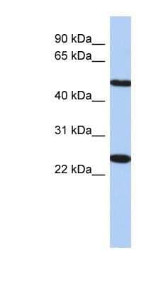 Western Blot: TMEM161B Antibody [NBP1-91443]