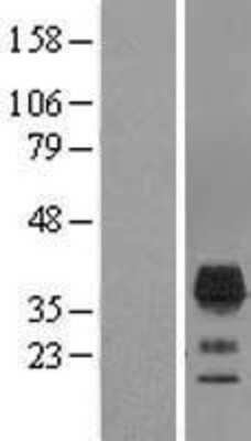 Western Blot: TMEM163 Overexpression Lysate [NBL1-17029]