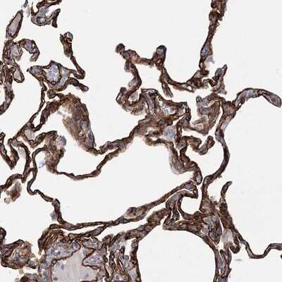 Immunohistochemistry-Paraffin: TMEM164 Antibody [NBP1-93939]