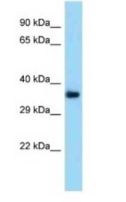 Western Blot: TMEM164 Antibody [NBP1-98383]