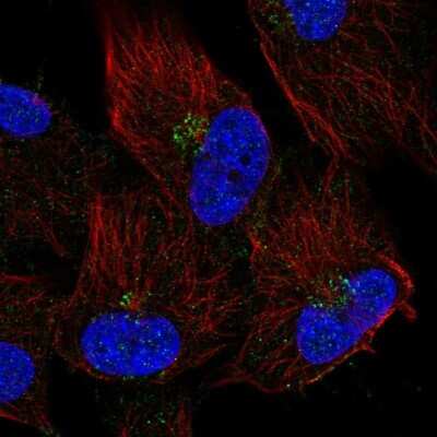 Immunocytochemistry/ Immunofluorescence: TMEM165 Antibody [NBP2-68788]