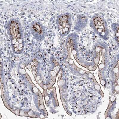 Immunohistochemistry-Paraffin: TMEM165 Antibody [NBP1-90651]