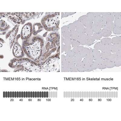 Immunohistochemistry-Paraffin: TMEM165 Antibody [NBP1-90651]