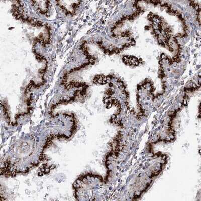 Immunohistochemistry-Paraffin: TMEM165 Antibody [NBP1-90651]
