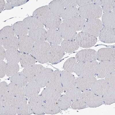 Immunohistochemistry-Paraffin: TMEM165 Antibody [NBP1-90651]