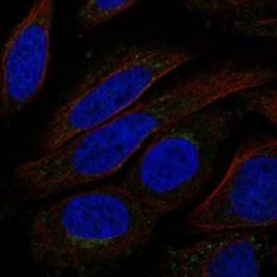 Immunocytochemistry/ Immunofluorescence: TMEM168 Antibody [NBP3-17321]