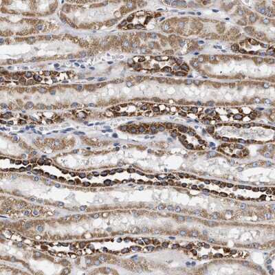 Immunohistochemistry-Paraffin: TMEM168 Antibody [NBP1-84160]