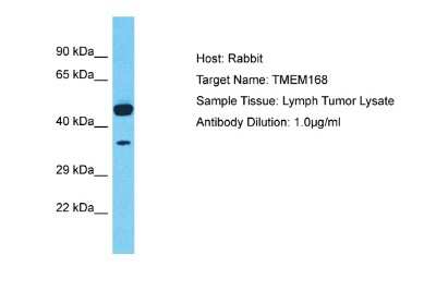 Western Blot: TMEM168 Antibody [NBP2-85938]