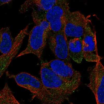 Immunocytochemistry/ Immunofluorescence: TMEM169 Antibody [NBP2-68790]