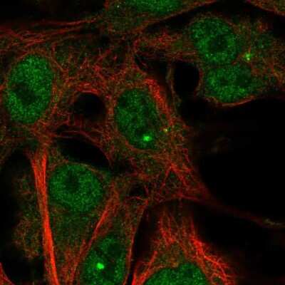 Immunocytochemistry/ Immunofluorescence: TMEM169 Antibody [NBP2-68796]