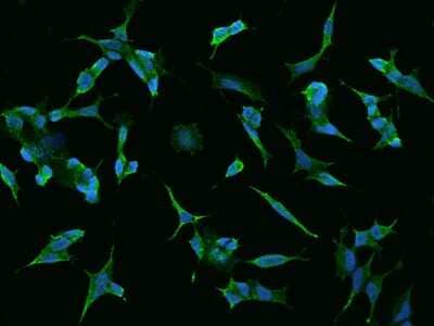 Immunocytochemistry/ Immunofluorescence: TMEM169 Antibody [NBP2-98157]