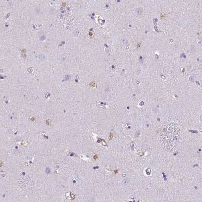 Immunohistochemistry-Paraffin: TMEM169 Antibody [NBP2-49642]