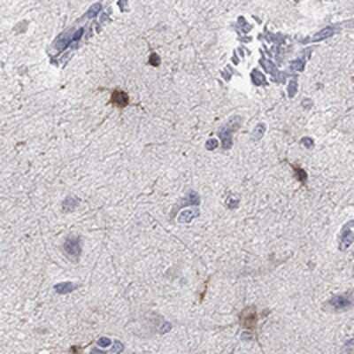 Immunohistochemistry-Paraffin: TMEM169 Antibody [NBP3-17949]