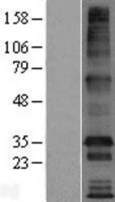 Western Blot: TMEM169 Overexpression Lysate [NBL1-17033]