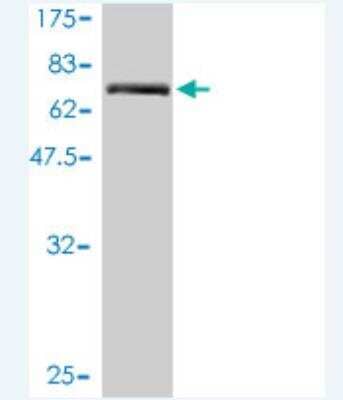 Western Blot: TMEM16K Antibody (2B12-1A11) [H00055129-M01]