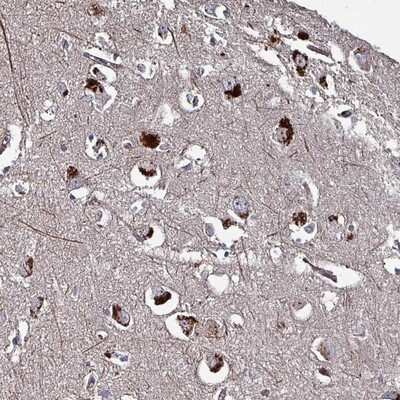 Immunohistochemistry-Paraffin: TMEM16K Antibody [NBP2-14297]