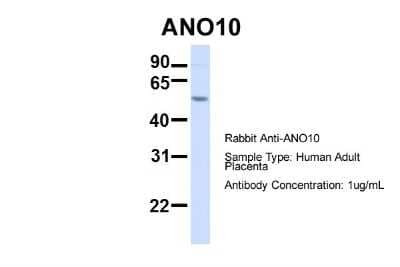 Western Blot: TMEM16K Antibody [NBP1-59667]