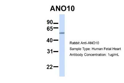 Western Blot: TMEM16K Antibody [NBP1-59667]