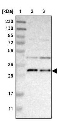 Western Blot: TMEM17 Antibody [NBP1-81974]