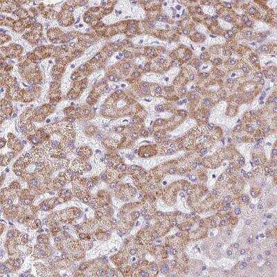 Immunohistochemistry-Paraffin: TMEM170A Antibody [NBP2-31593]