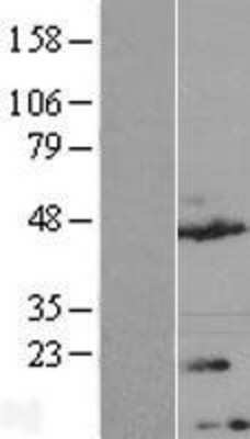 Western Blot: TMEM170A Overexpression Lysate [NBL1-17036]