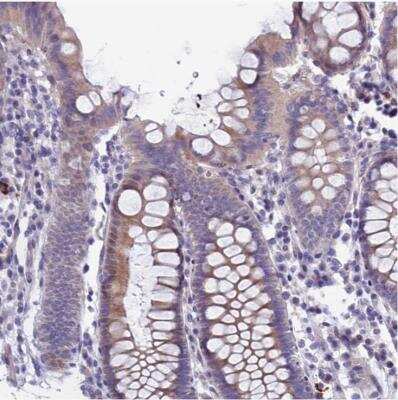 Immunohistochemistry-Paraffin: TMEM171 Antibody [NBP1-80876]