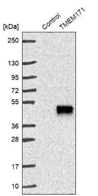 Western Blot: TMEM171 Antibody [NBP1-80876]