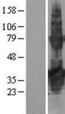 Western Blot: TMEM171 Overexpression Lysate [NBL1-17037]