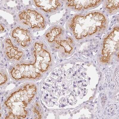 Immunohistochemistry-Paraffin: TMEM174 Antibody [NBP1-82023]