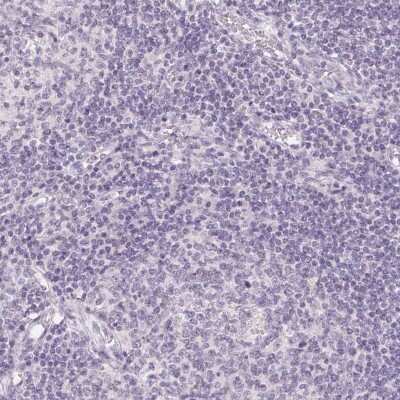 Immunohistochemistry-Paraffin: TMEM174 Antibody [NBP1-82023]