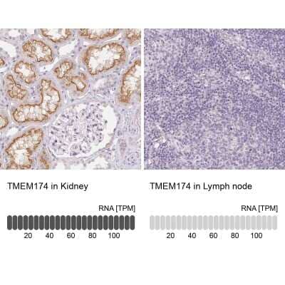 Immunohistochemistry-Paraffin: TMEM174 Antibody [NBP1-82023]