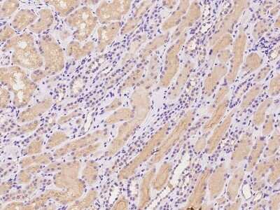 Immunohistochemistry-Paraffin: TMEM174 Antibody [NBP2-97867]