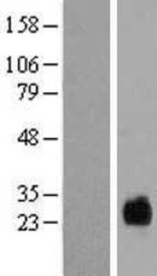 Western Blot: TMEM174 Overexpression Lysate [NBL1-17039]